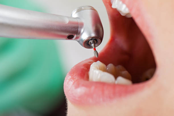 Best Emergency Broken Tooth Repair in Harrisburg, PA